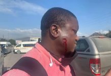 Mweli Masilela suffers face injury in line of duty Mweli Masilela suffers face injury in line of duty