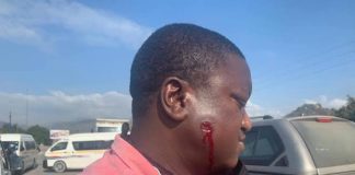 Mweli Masilela suffers face injury in line of duty Mweli Masilela suffers face injury in line of duty
